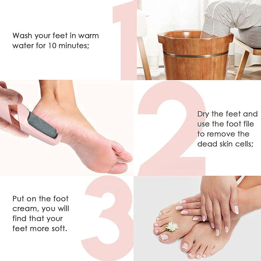 Electric Callus Remover